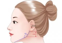 削骨手術(shù)后遺癥有哪些？多少錢?必看指南！